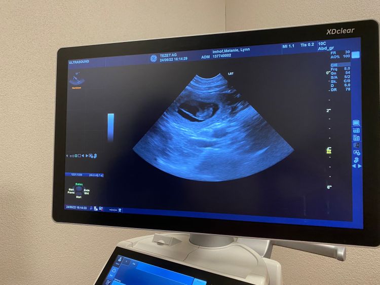 Ultraschall Lynn - Phinegean wird zum drittel Papa